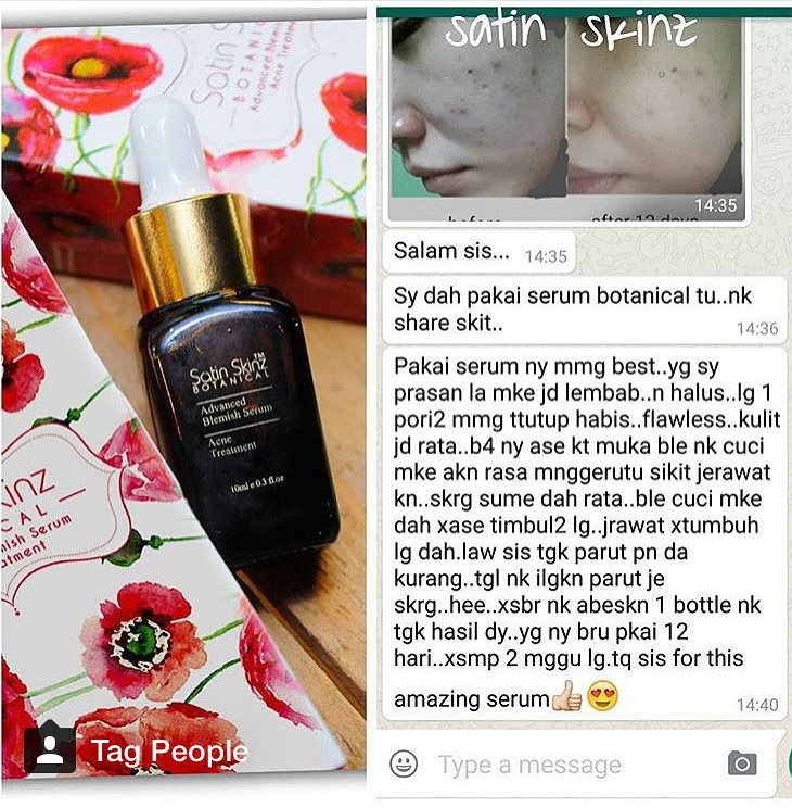 Satin Skinz Botanical serum for a youthful and glowing complexion