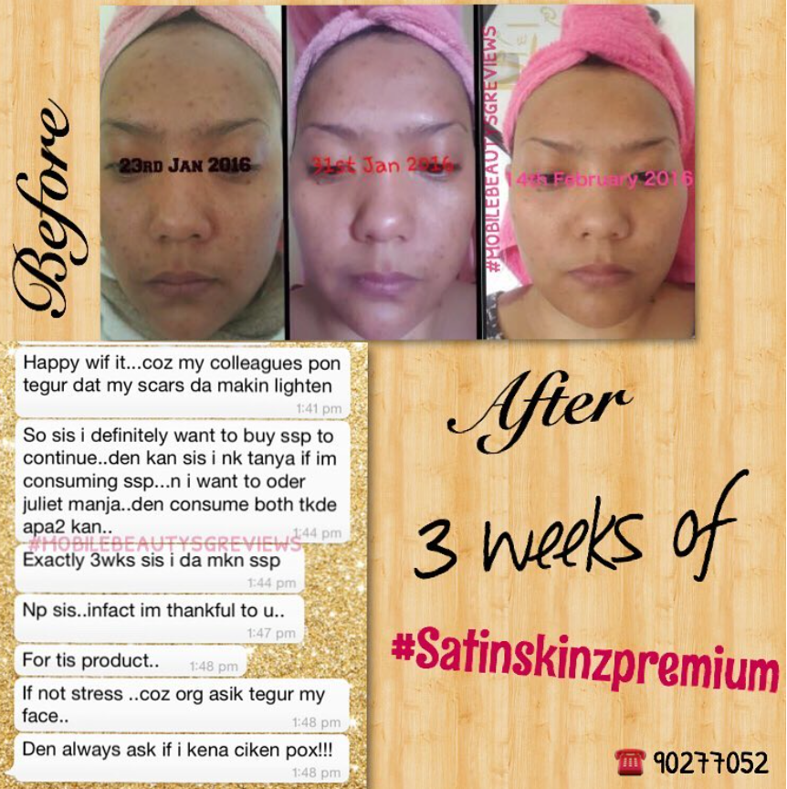 Skin tone even up after 3 weeks of satin skinz premium!