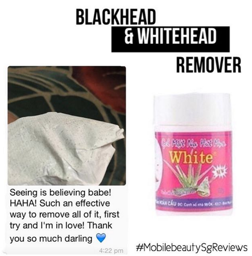 VWM blackhead & whitehead remover