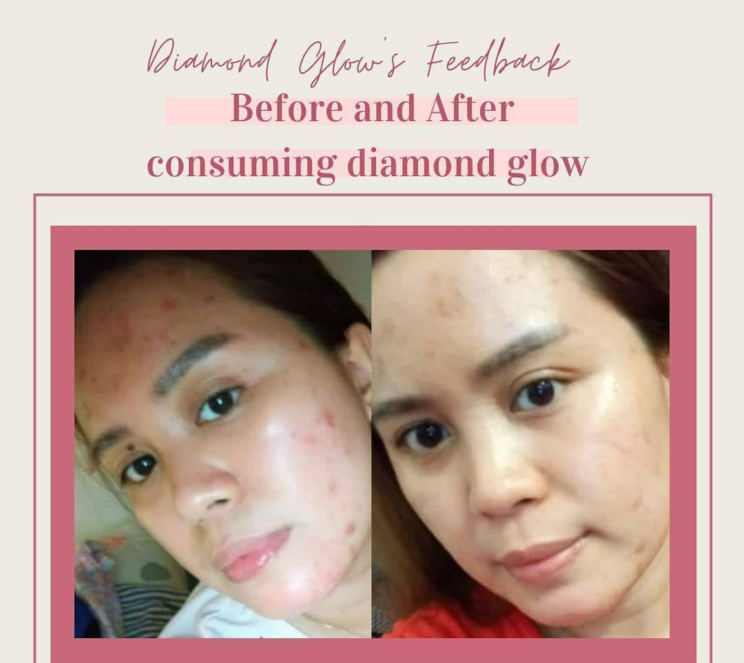Diamond Skin Glow